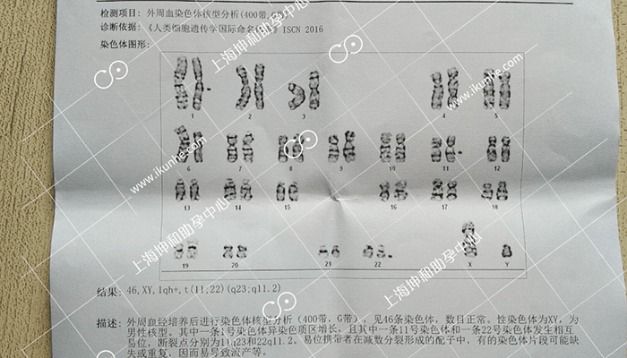 染色体异常