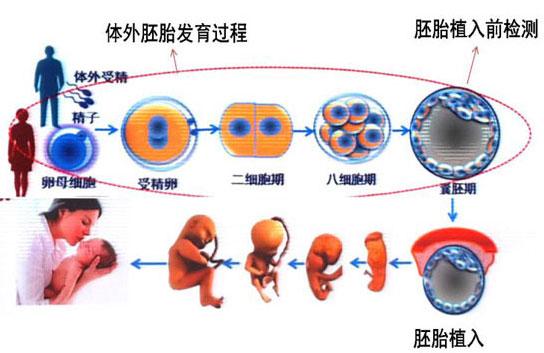 三孩政策  试管婴儿